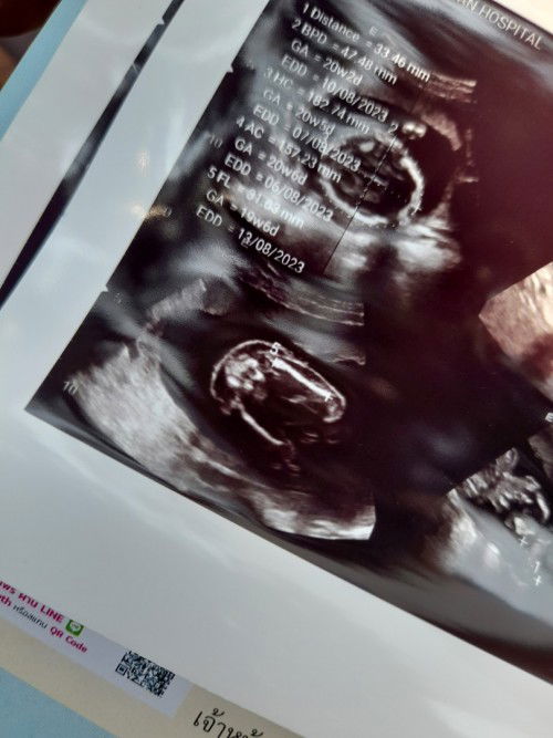 รบกวนแม่ๆช่วยดูหน่อยค่ะ