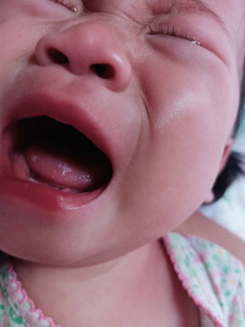 ลิ้นลูกเป็นจุดขาวๆทำไงดีคะ