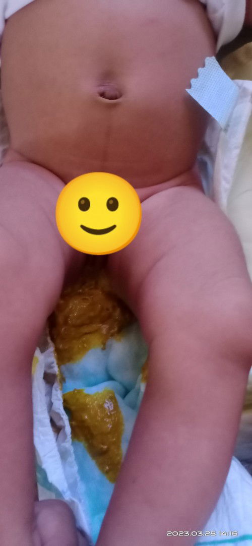 Hello ka momshie normal poba sa 1 month ang ganito na poops? Basa na sticky po? Salamat