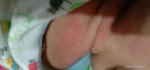 Bagi tips atau pengalaman nya dong bund..bagaimana cara mengatasinya nggak tega rasanya 🥺
