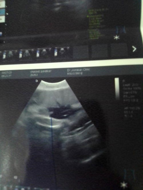 สอบถามหน่อยค่ะแม่ๆอันนี้คือจู๋น้องใช่ไหมค่ะ