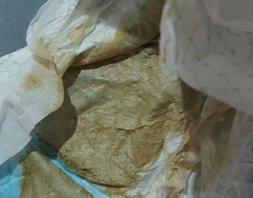 mga mhie normal lang kaya ang popo na ganyan .. formula po.sana masagot salamat