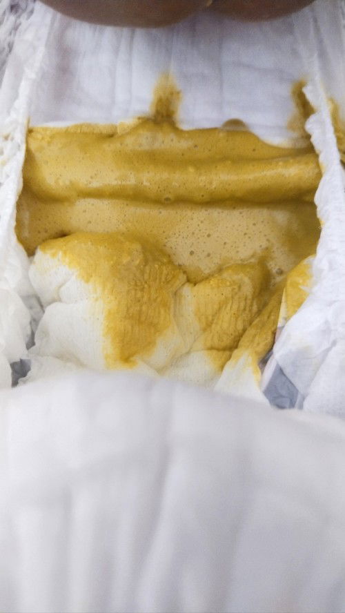 อึมีฟอง อึเหลวค่ะ