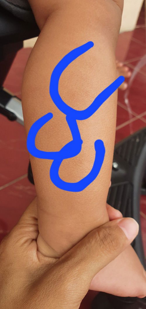 Penghilang jamur pada bayi