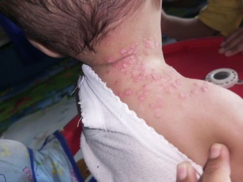 Ini pertamanya sedikit tapi lamalama kenapa banyak yah kirakira knpa yah bunda2 ? Ada yang sama