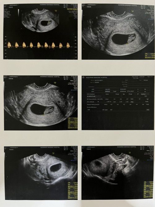 อดใจไม่ไหว ยังไม่8W เลย