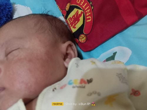 Bun maaf dsini ada gak ya anak nya yg sprti anak saya,muka nya kyk gini,mnta saran donk pke apa y ?