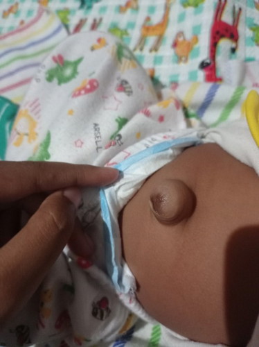 Pusar anak saya kok gini ya bun