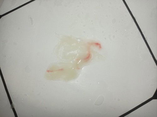 Keputihan campur darah