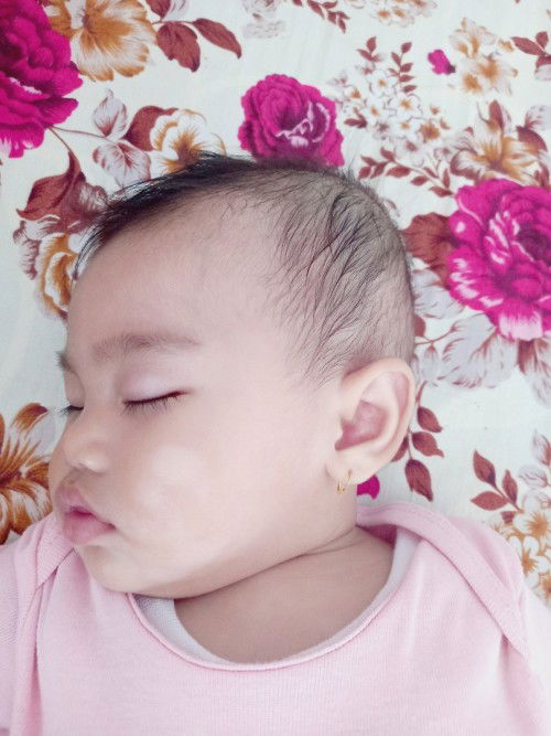 Bercak putih di wajah (full Asi)