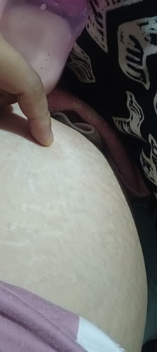 4 days na po akong naka panganak. Bakit po kaya matigas parin part po na to?