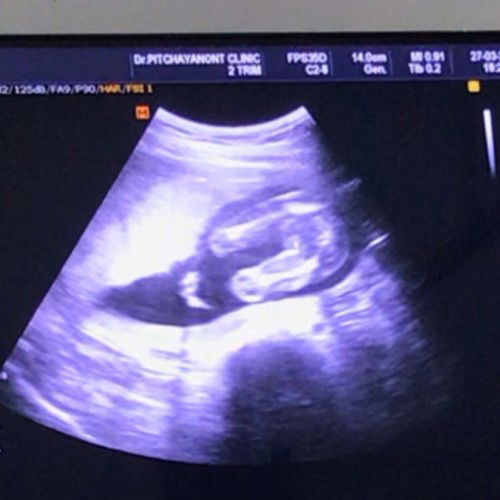 แบบนี้ชายหรือหญิงค่ะ