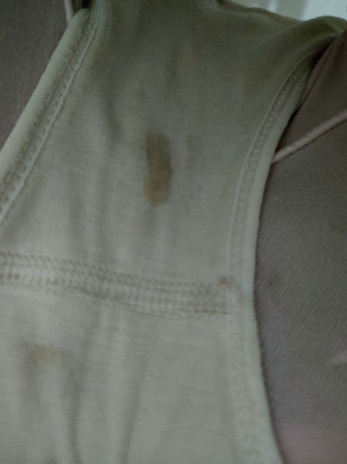 Maaf bund dgn fto ini ,klo flek kcokltn ky gni,hbis itu kluar keputihan seperti biasa,bhya ga bund😌