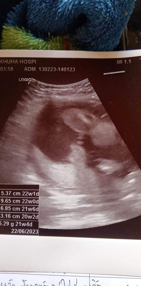 แม่ๆช่วยดูหน่อยค่ะว่าน้องเป็นผู้หญิงหรือผู้ชาย