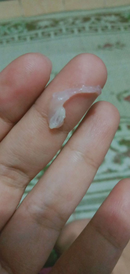 Hpl 25 maret sampai sekarang belum ada kontraksi