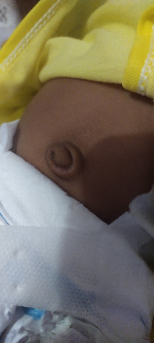 Perawatan pusar bayi