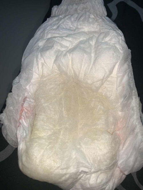 Apakah ini termasuk warna pipis yang berbahaya