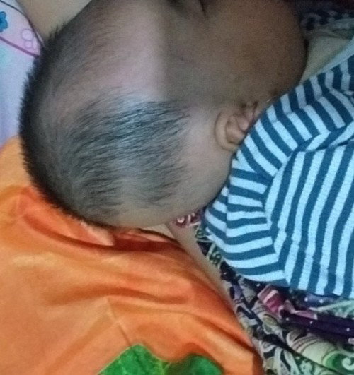 Kepala bayi peyang