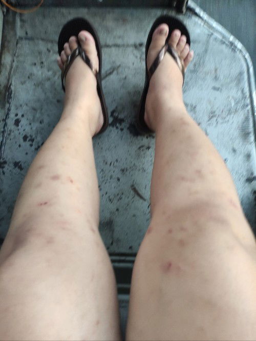 katikati sa balat o sa katawan Ng buntis/ 6 months preggy