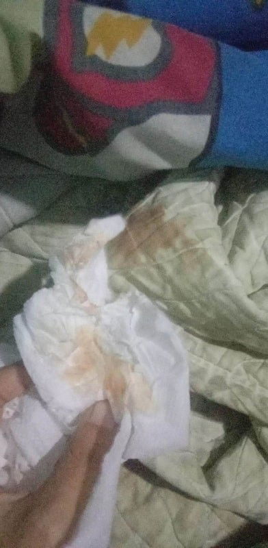 มีเลือดออกตอน7เดือน