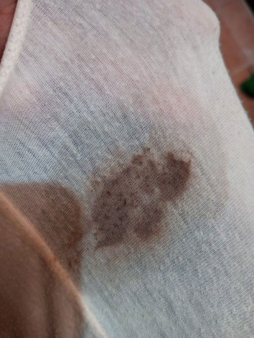 Mucus plug or hindi?