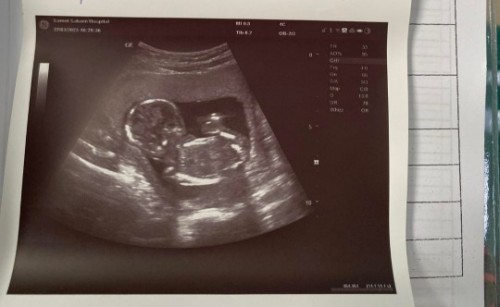 ท้องแรก15w3d ตัวน้องใช่ไหมคะ