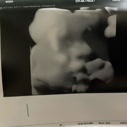 เอารูปมาอวด