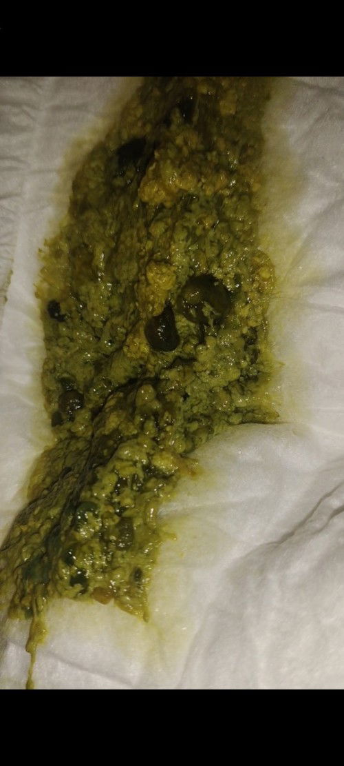 Tolong bantu jawab, sakit apa?