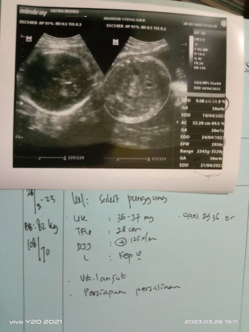 Hasil usg usia 36-37minggu
