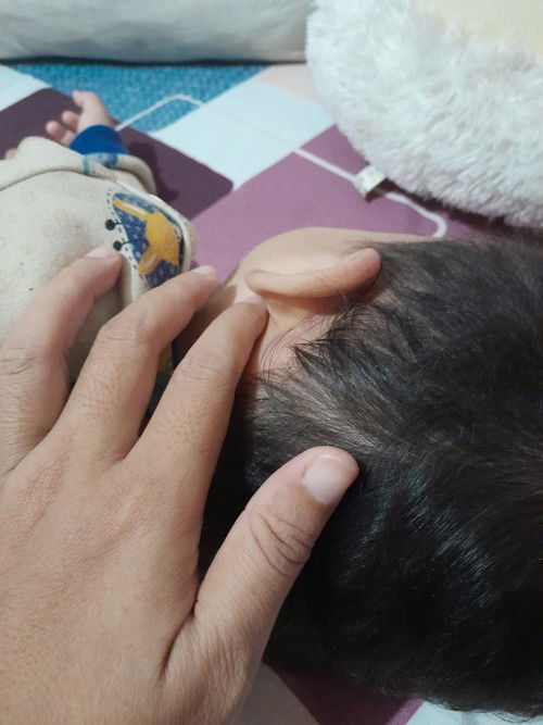 Benjolan kecil² seperti kacang tanah