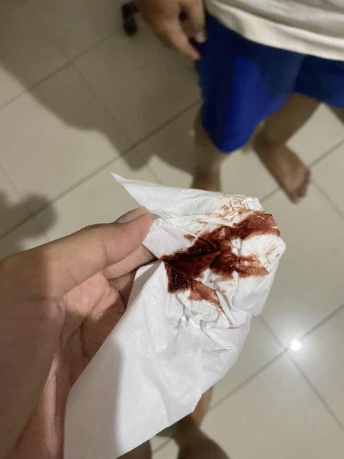 Keluar darah 13 week