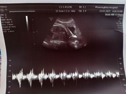 ทีม กรกฏาคม