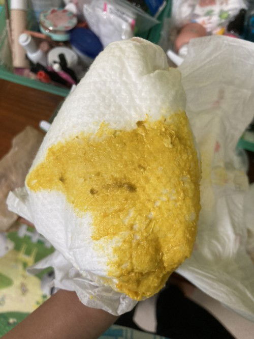 อึลูกเป็นสีเขียวๆ ปนมา