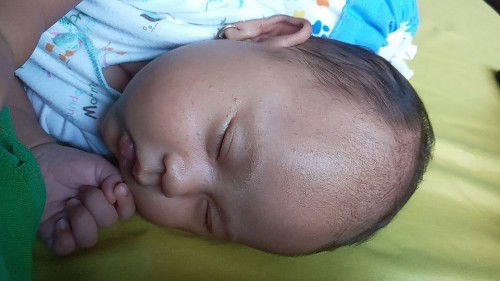 Bruntusan di muka bayi umur 1 bulan obatnya apa ya bun?
