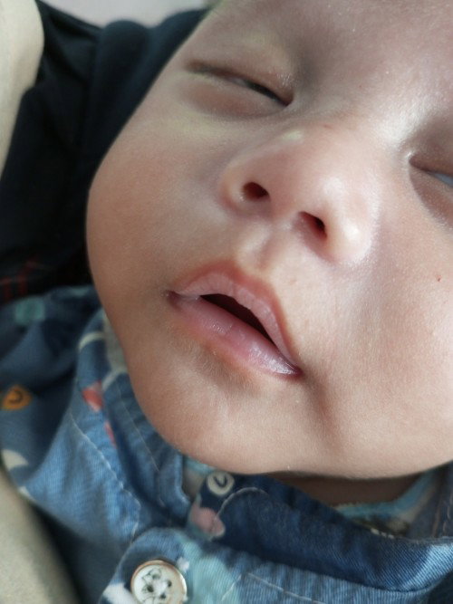 Bibir putih