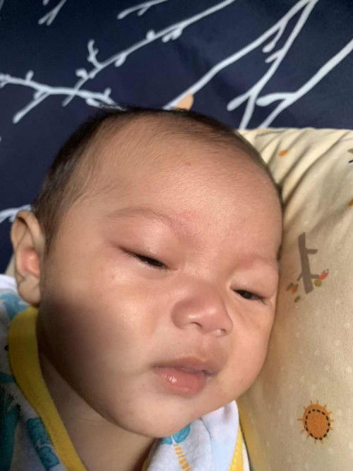 kenapa muka ankku bnyk merah begini