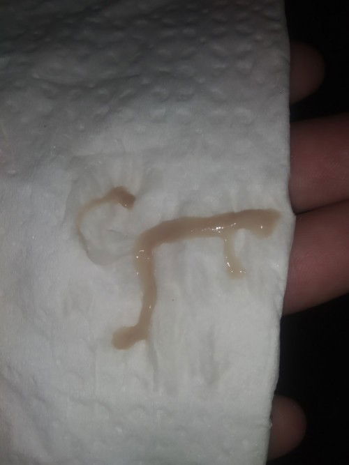 39+1 สัปดาห์ ท้องเสีย มีมูกออก