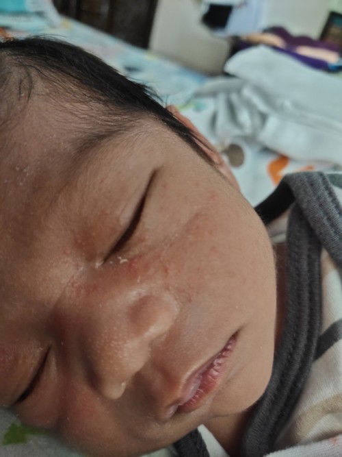 Ano po yung nasa face ni baby