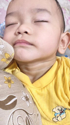 Garis leher putih pada bayi