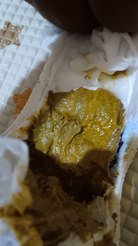 Bun bbyku umur 3bln fases warna seperti ini normal apa gimana bun?