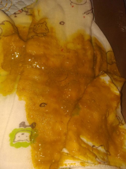 สีอึลูกเป็นเเบบนี้ปกติไหมคะ