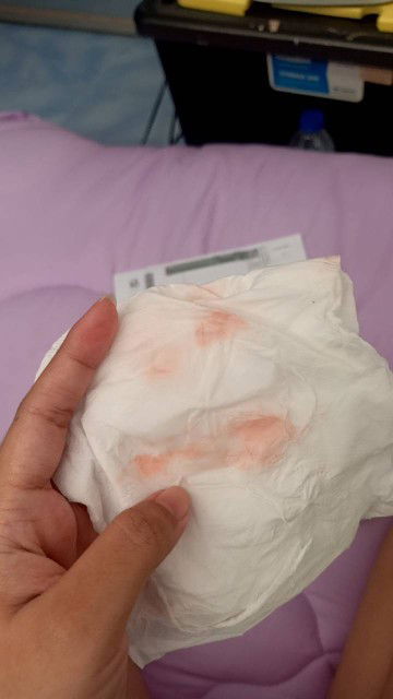 มีเลือดและลิ่มเลือดออกจากอวัยวะเพศ