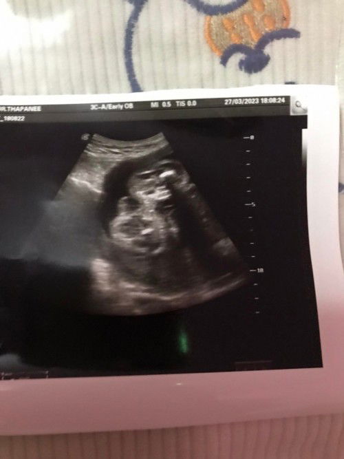 แม่ๆช่วยดูเพศหน่อยค่ะ