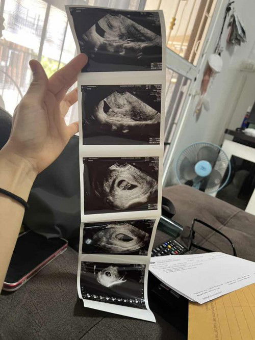 เพิ่งจะดีใจไปแท้ ๆ  ต้องมากังวลต่ออีก 😞😞