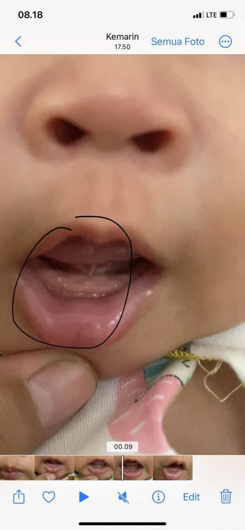 Bu ibu mohon infonya yaaa