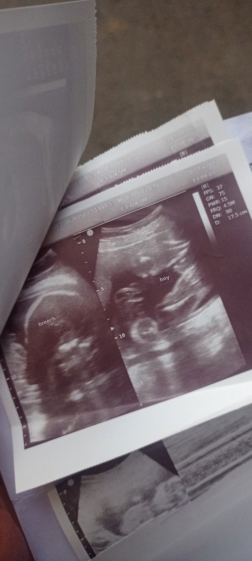 sure baby boy napo kaya ito? 😍😇 
sana po may makasagot ...