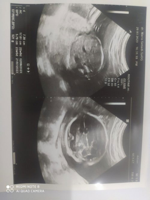 Bun mau tanya ini brpa week yaa...