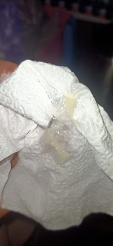 มูกหรือตกขาว