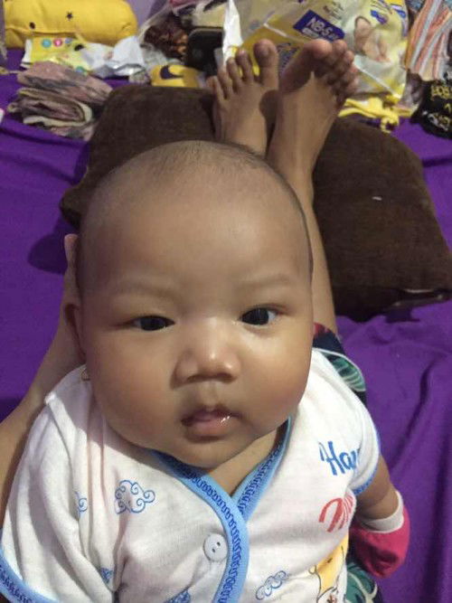 Mata bayi1 bulan sipit sebelah