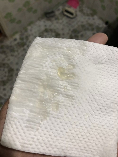 มีมูกใส 39+6 week